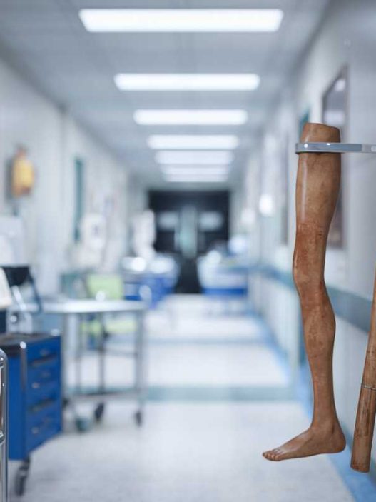 Santé : L’harmonisation des tarifs hospitaliers pour 2025, une victoire financière ou un pansement sur une jambe de bois ?