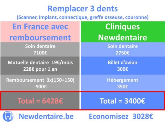 découvrez tout ce qu'il faut savoir sur le remboursement dentaire : guide complet des démarches, des taux de remboursement, et astuces pour optimiser vos soins dentaires. ne laissez pas les frais dentaires vous freiner, informez-vous !